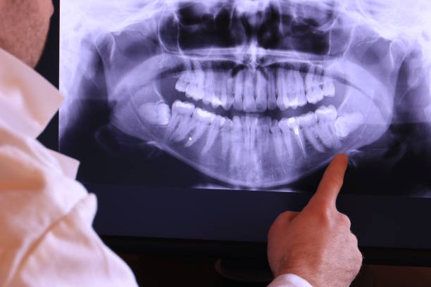Best Broken Tooth Emergency  in Short Pump, VA