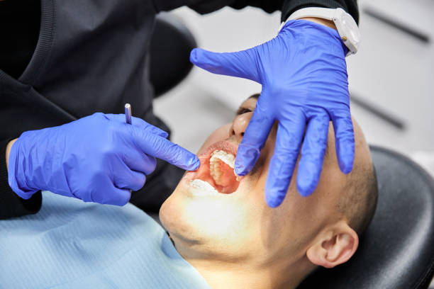 Best Dentist for Tooth Abscess  in Short Pump, VA