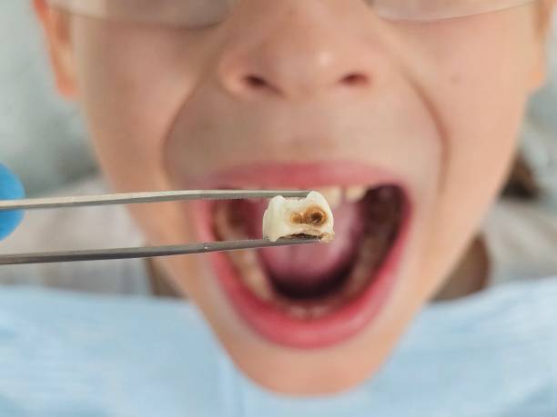Best Emergency Tooth Extraction  in Short Pump, VA
